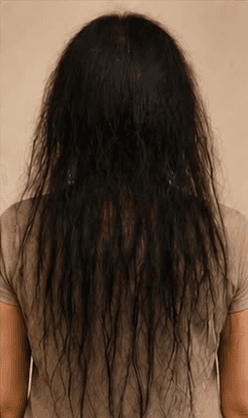 Avant la cure : cheveux longs très secs et frisottés, pointes clairsemées et transparentes